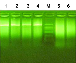 Thermostable M-MLV Reverse Transcriptase