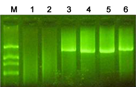 Thermostable M-MLV Reverse Transcriptase