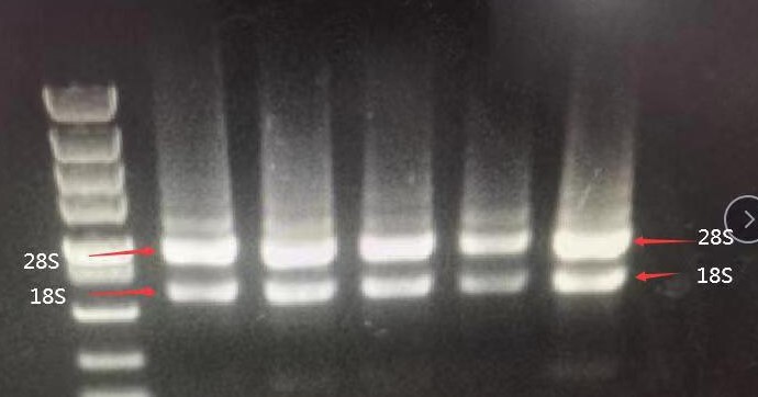 RNA Extraction Quality